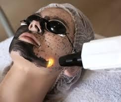 Sharplight Carbon Facial Sharplight Carbon Facial