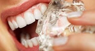 Teeth Whitening Cobourg Teeth Whitening Cobourg